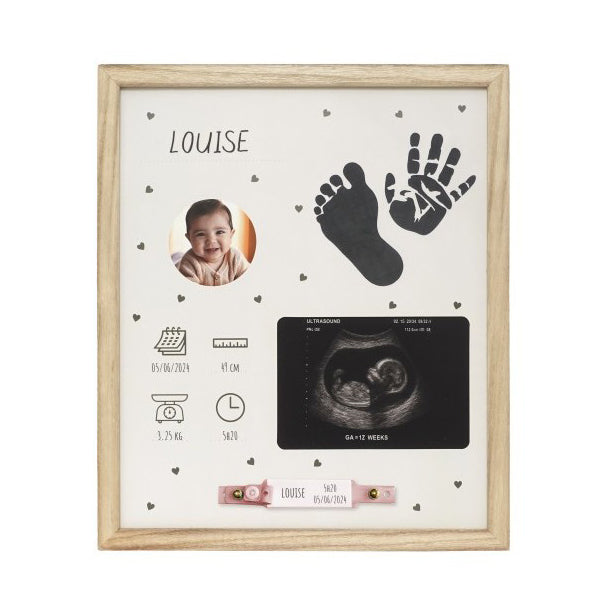 Birth frame